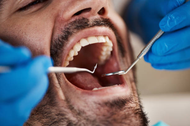 Best Emergency Treatment for Dental Infections or Abscesses in Brushy Creek, TX